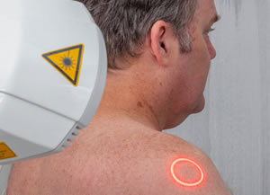 Low Level Laser Therapy